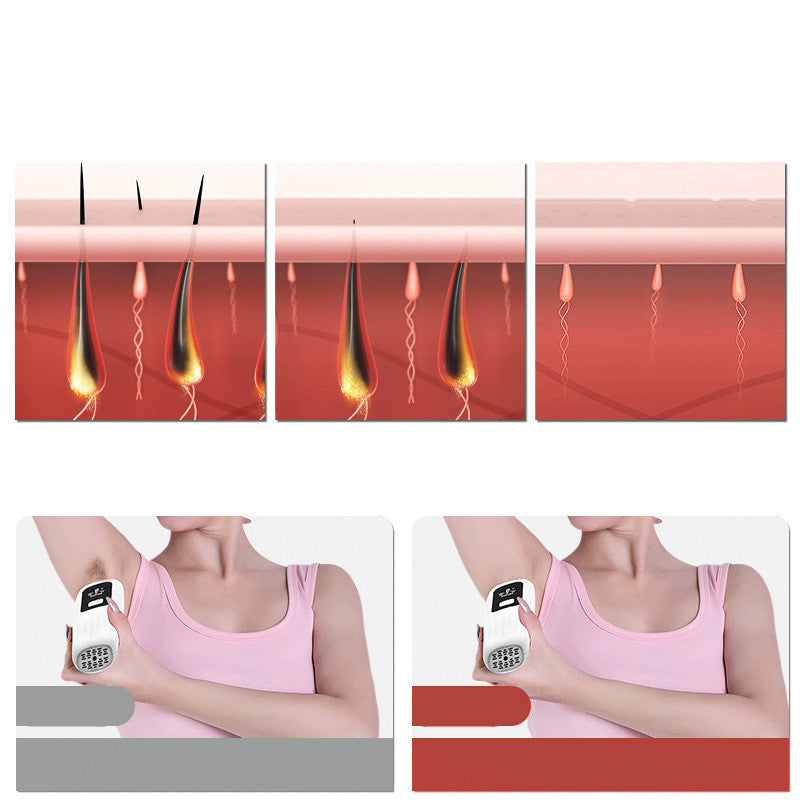 IPL Laser Hair Removal Apparatus