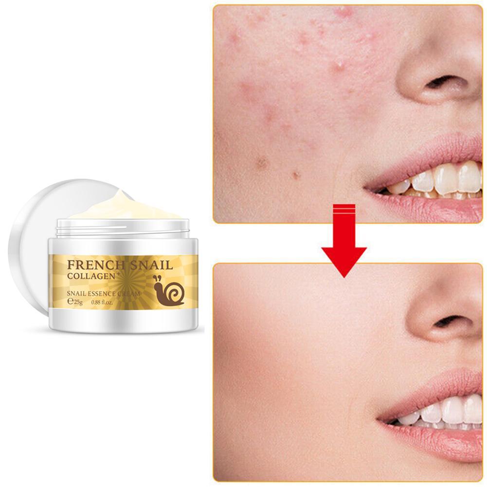 Snail Rejuvenating Hyaluronic Acid Moisturizer Face Cream